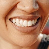 A close-up of a woman's smile, showcasing healthy teeth and natural skin tone.